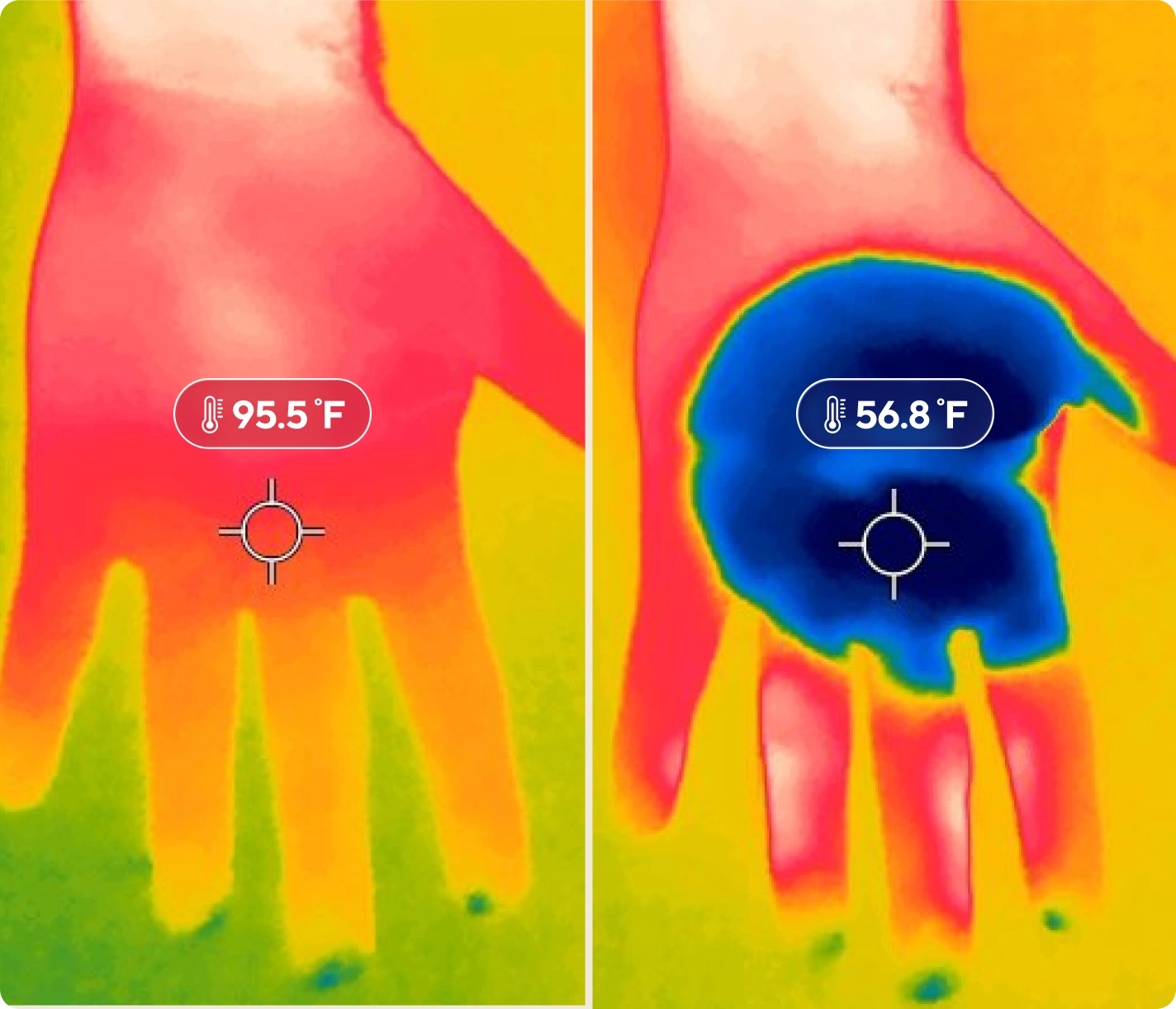 CryoTherm™ Palm - Image 7